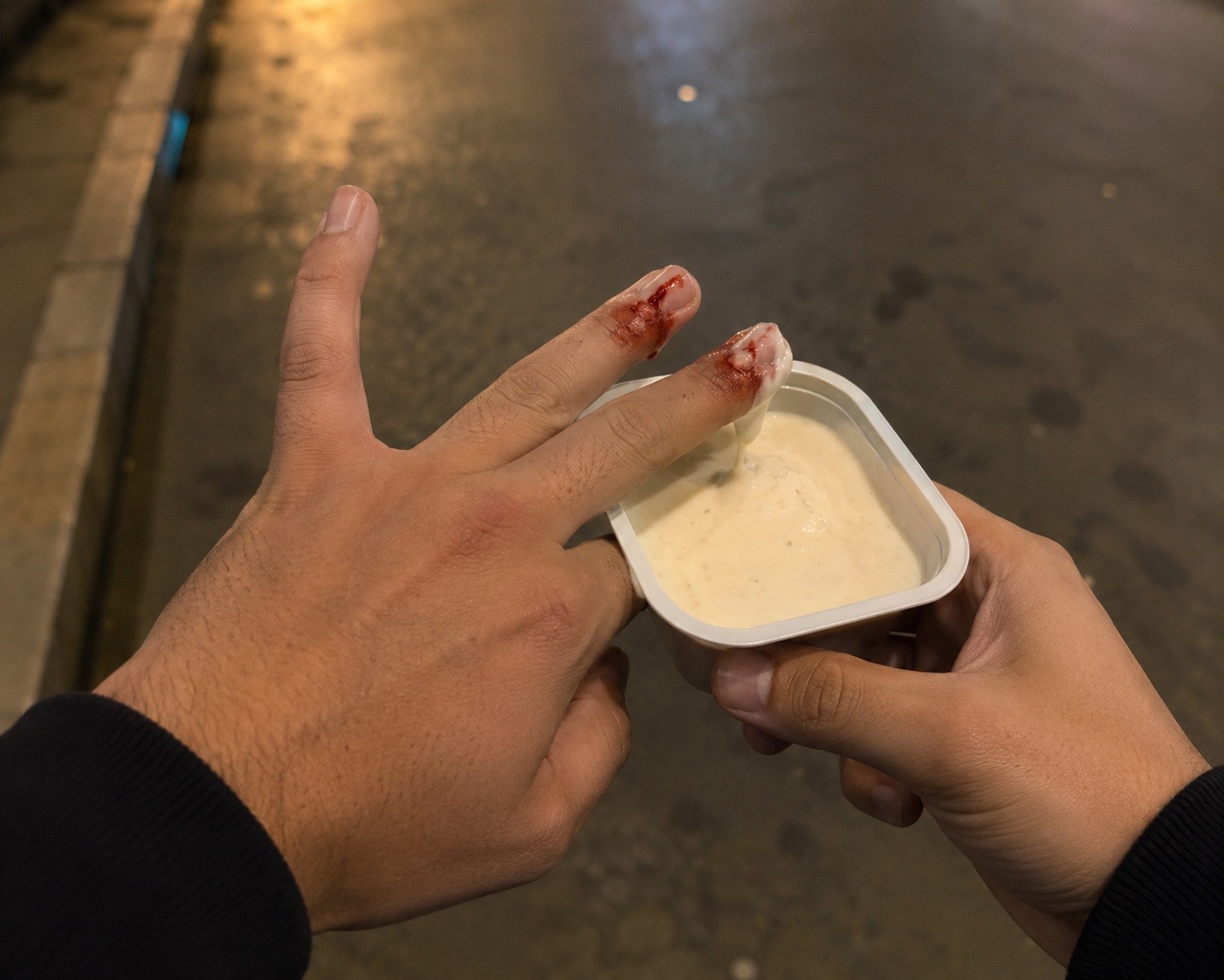 تفسير رؤيا كسر اصبعي وغمسه فى الصوص 👈🍚